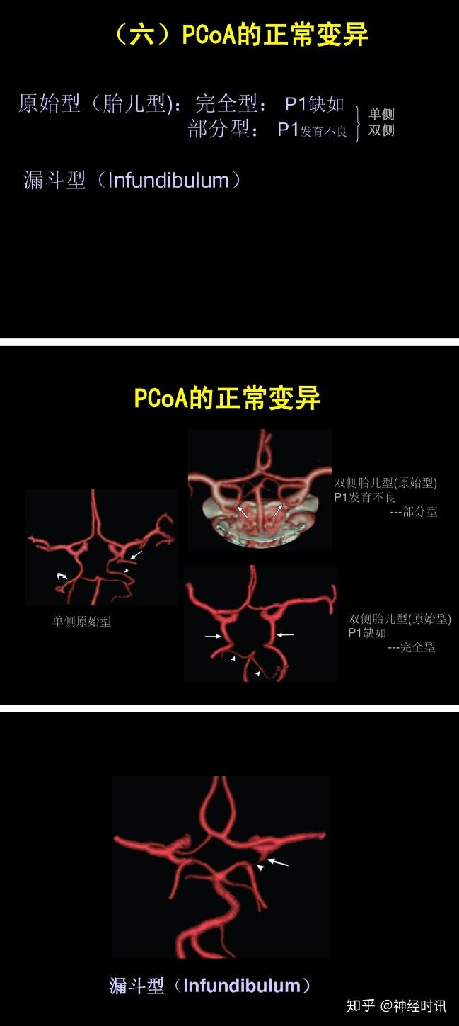 是頸內動脈系,椎一基底動脈還是連接他們的willis環均位於腦的腹側面