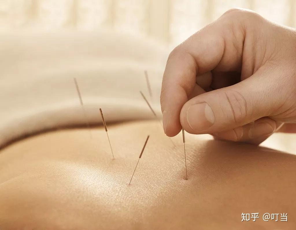 湖北中医药大学孔立红谈针灸在辅助生殖中的应用