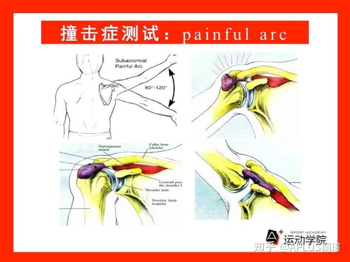 常用肩关节损伤评估