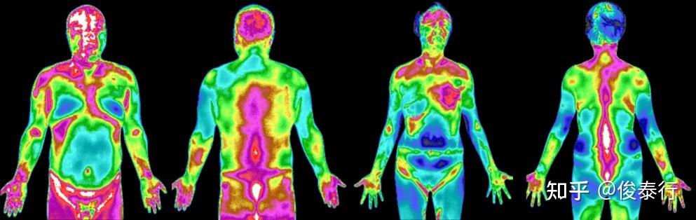 医用红外热像技术是一种被动接收人体组织细胞代谢热源的功能影像技术