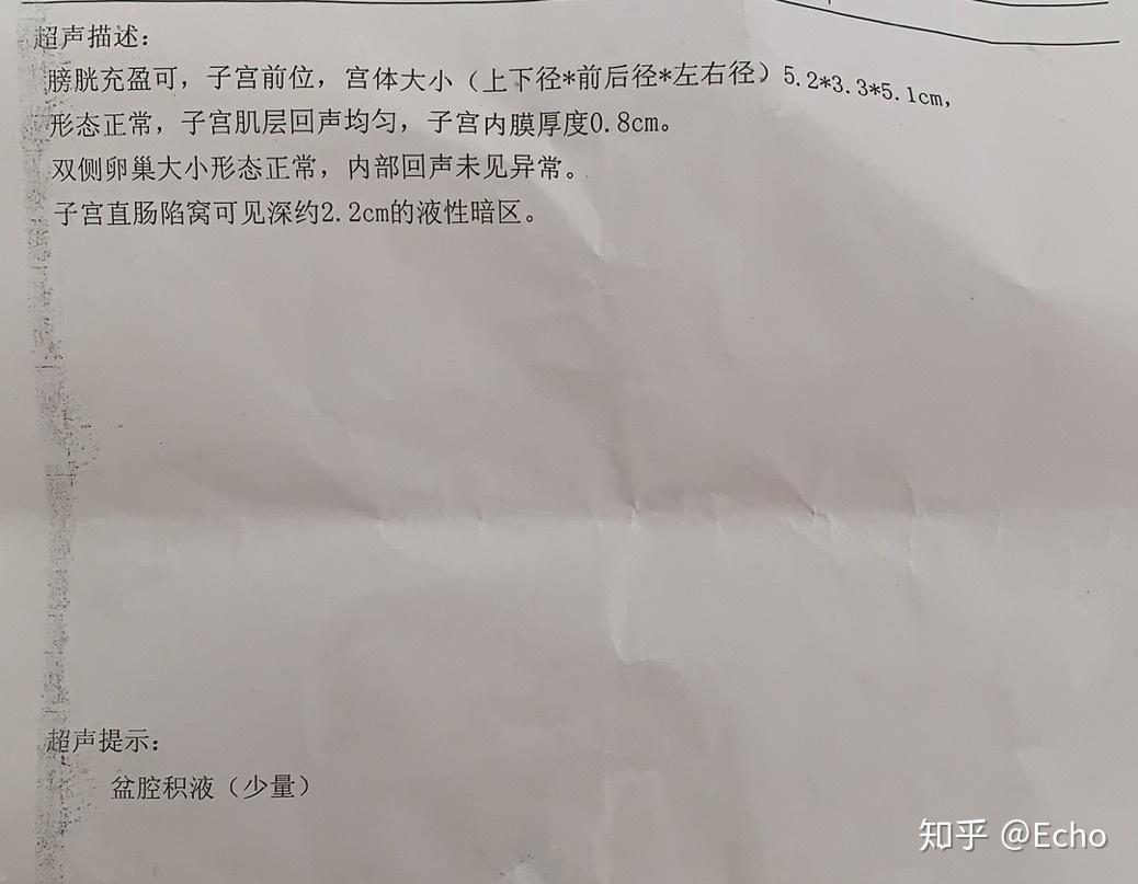 卵巢囊肿病例图片图片