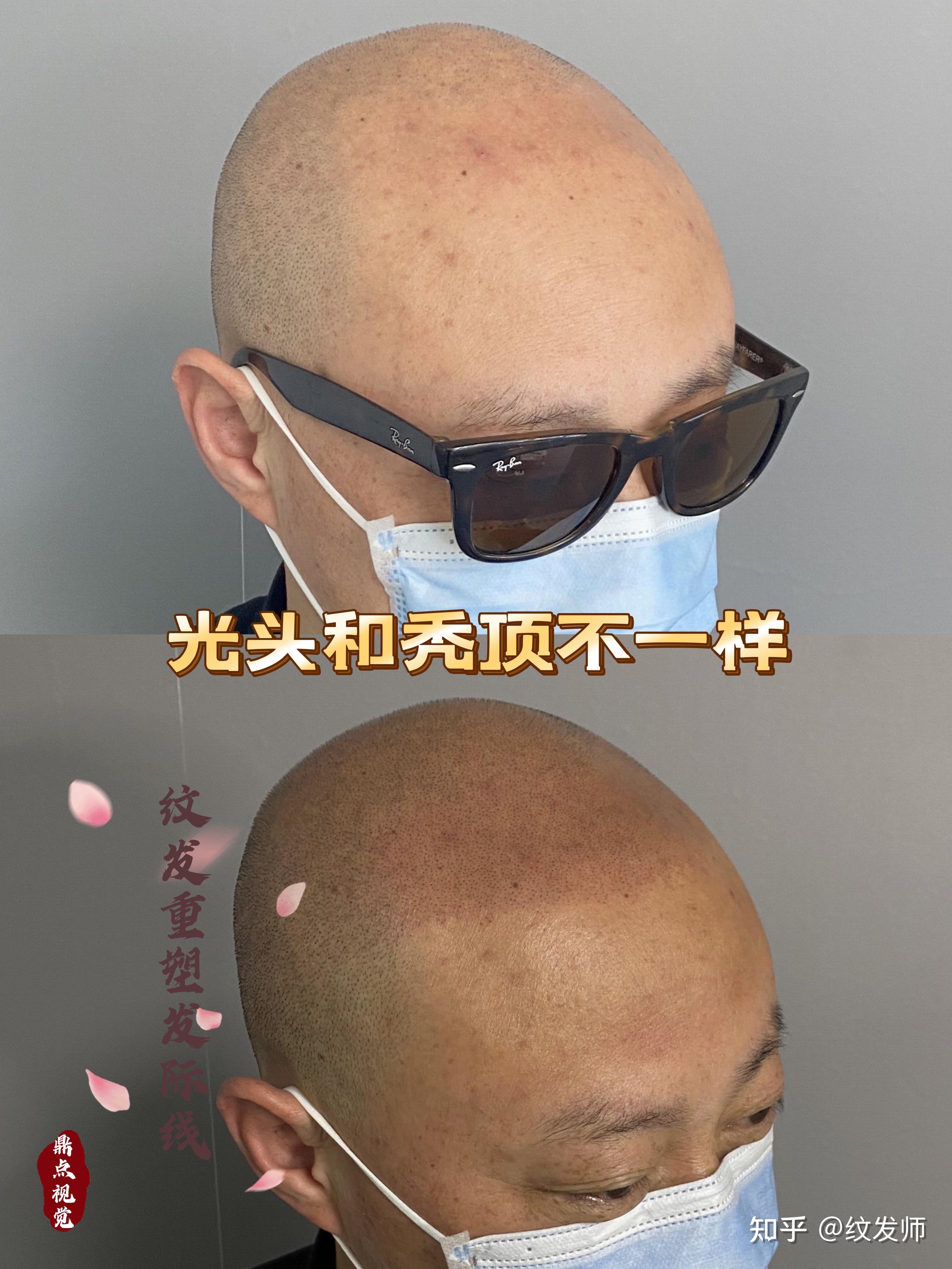 大s老公具俊晔的头发是纹的你听说过纹发吗