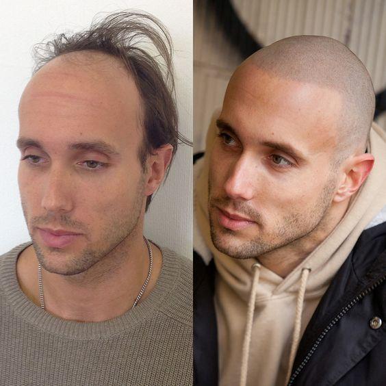 头发稀疏的男士选择光头之后,也要定期的修剪,否