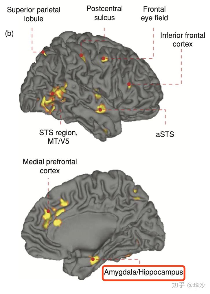 如果杏仁核缺失会怎么样？ - 知乎
