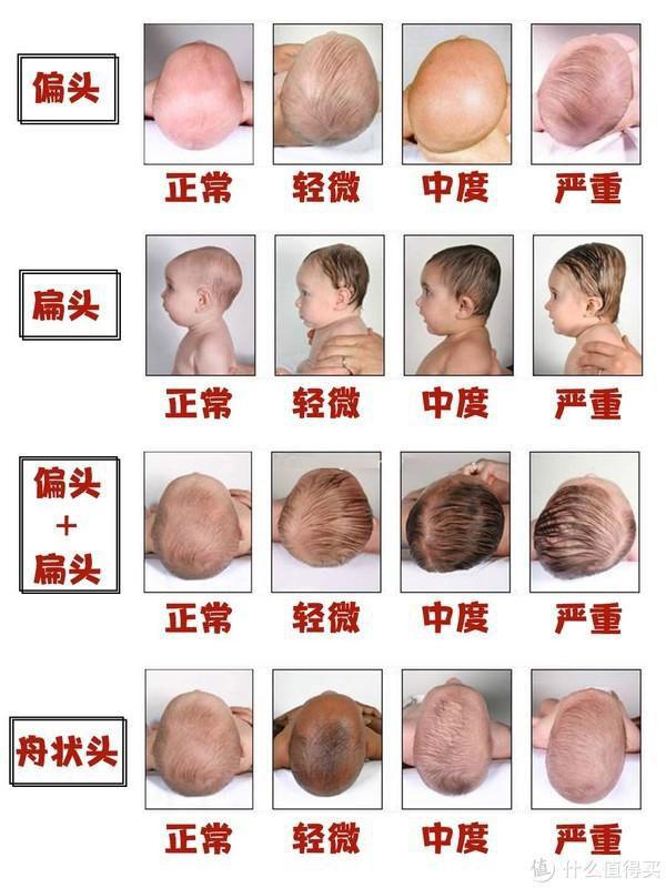新生儿头型图片 标准图片