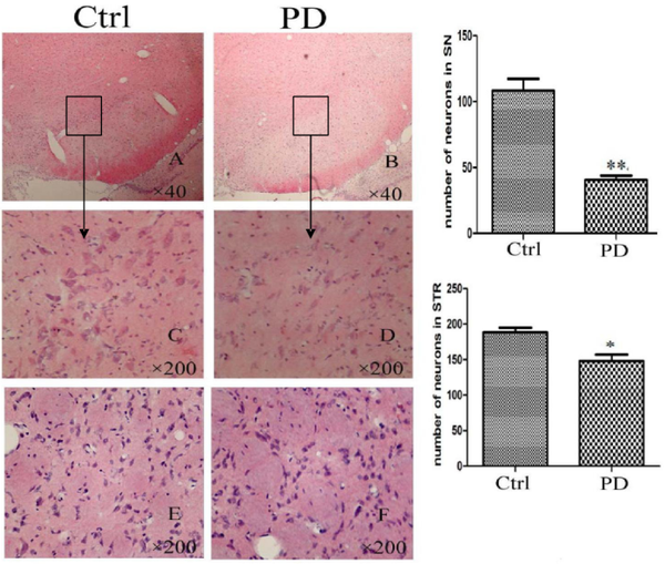 小布新品｜PD动物模型助力神经系统疾病药物治疗 知乎