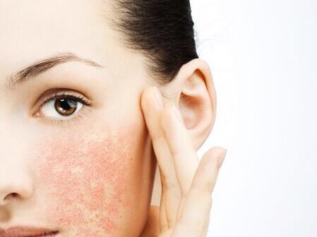 欧兰素专业护肤为什么你的脸部那么容易发红发热呢
