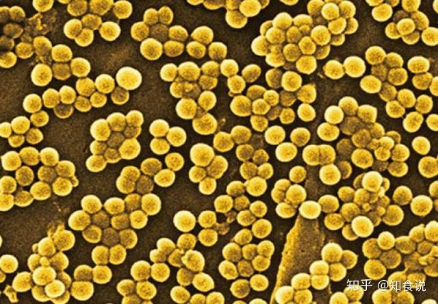 雀巢nan早产儿配方奶粉霉菌超标,智利卫生部呼吁消费者禁食用