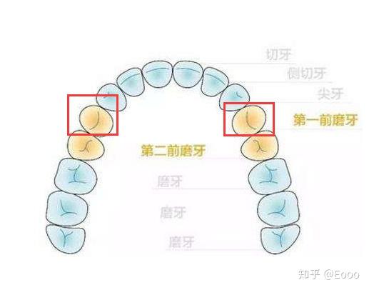 拔牙记 |四颗智齿 四颗前磨牙 附详细花费 - 知乎