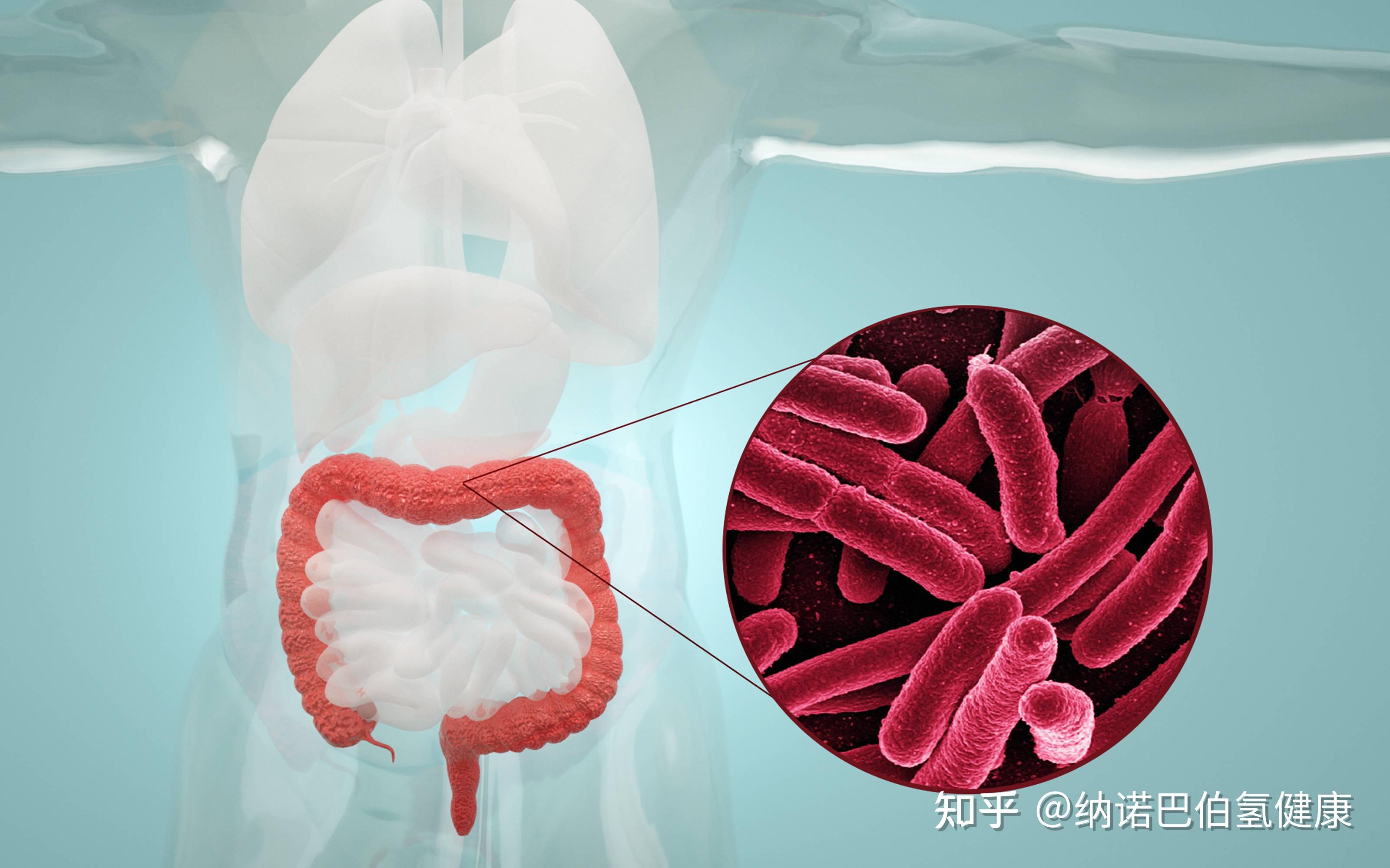 氫氣治療結腸炎堪比柳氮磺吡啶