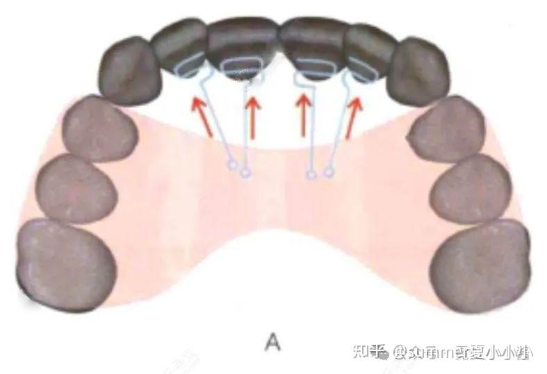 舌头贴上颚,能让鼻基底变高、脸变立体变好看? - 知乎