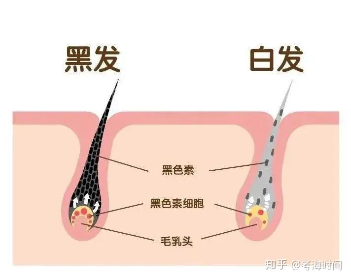 引起白发的原因为什么年纪轻轻就会长白头发,白头发到底能不能拔?