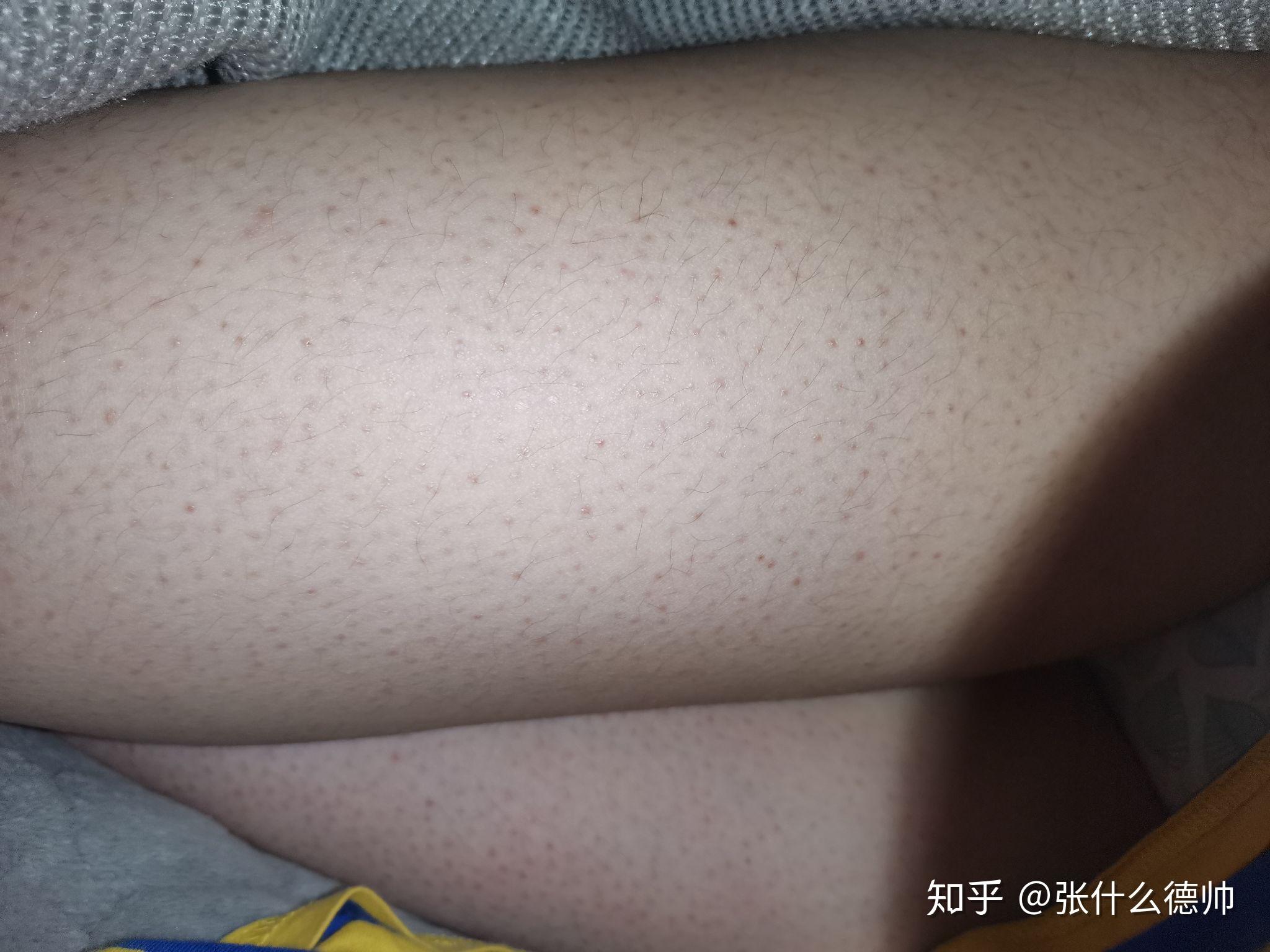 鸡皮肤分几个类型(鸡的皮肤特点是什么)