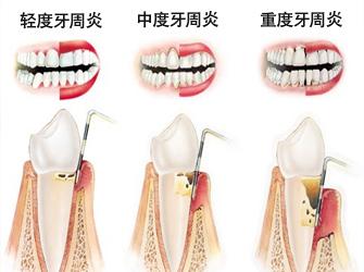v2-fab27cf3644e5b9b0ff750be49e2f38a_1440w.jpg?source=172ae18b