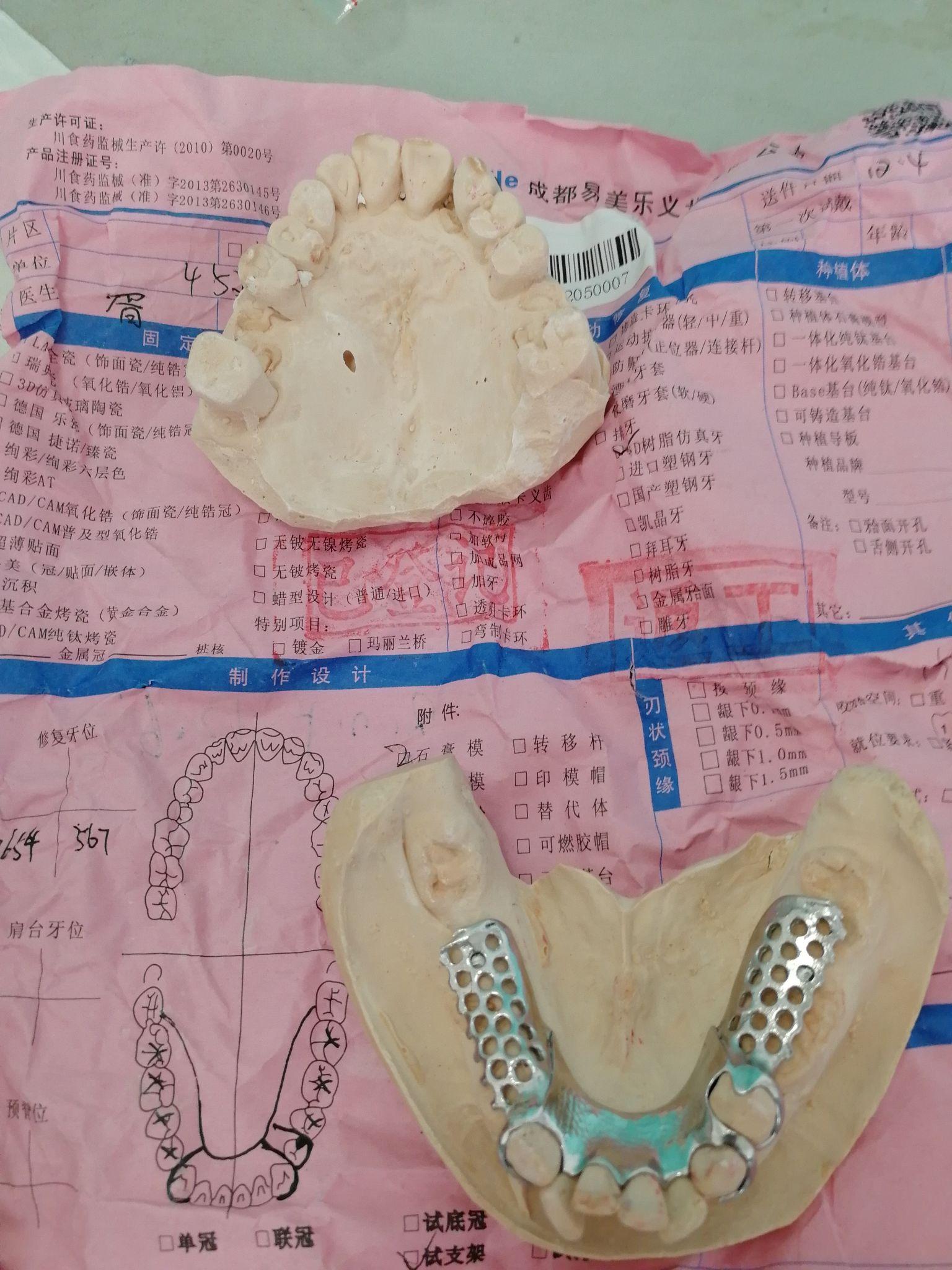 古吉第修复右下4567左下567