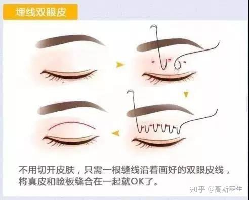 v2-fac28ec3d28e382fc0e1671c96b38ad1_r.jpg