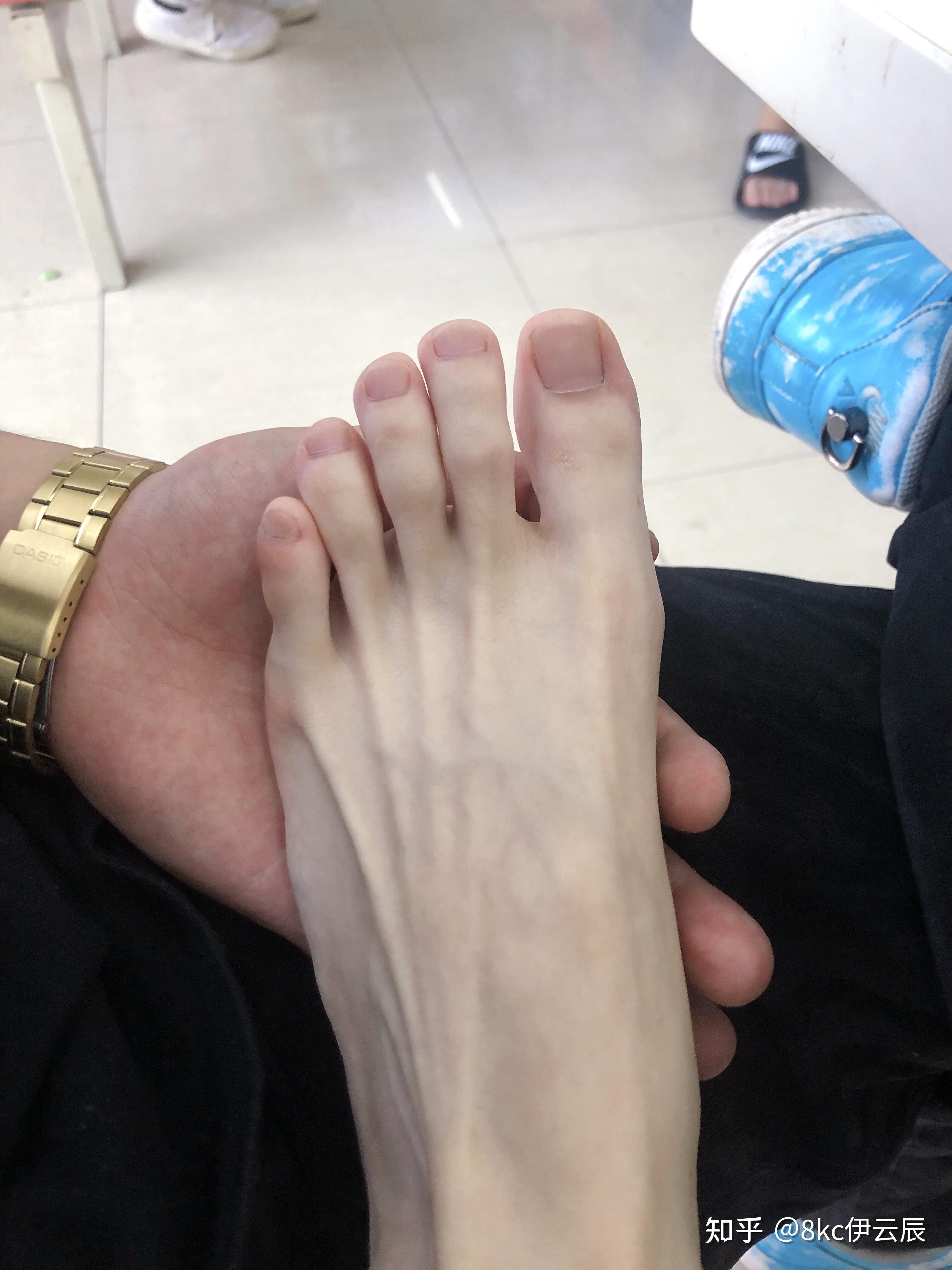 的的脚指甲,到现在健健康康的指甲,而且硬生生的把男友变成了一个足控