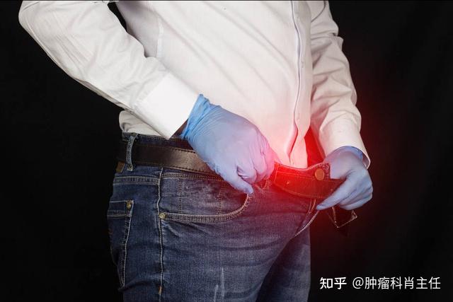 男性出现尿急尿痛千万别大意,小心是前列腺癌在作祟!