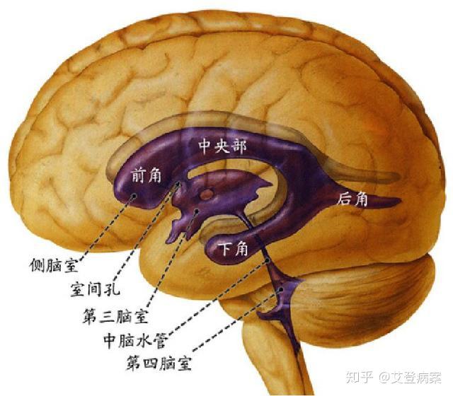 神经系统手术编码案例讲解 - 知乎
