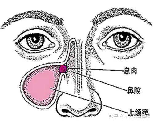 v2-fb3898964f6efe181817cc787c57e541_r.jpg