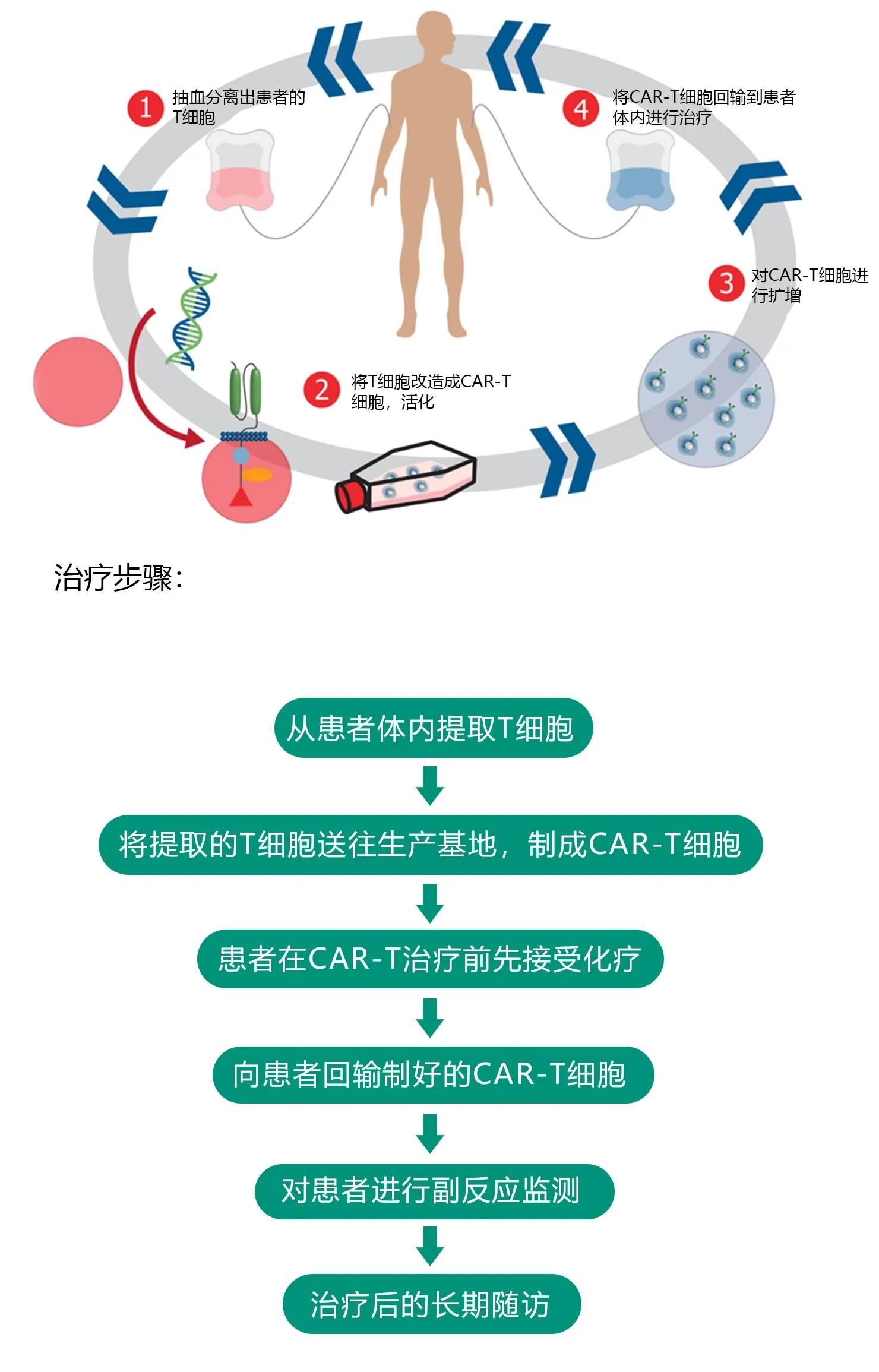 二,一针下去杀死癌细胞,传说中的"car-t"疗法究竟是啥?