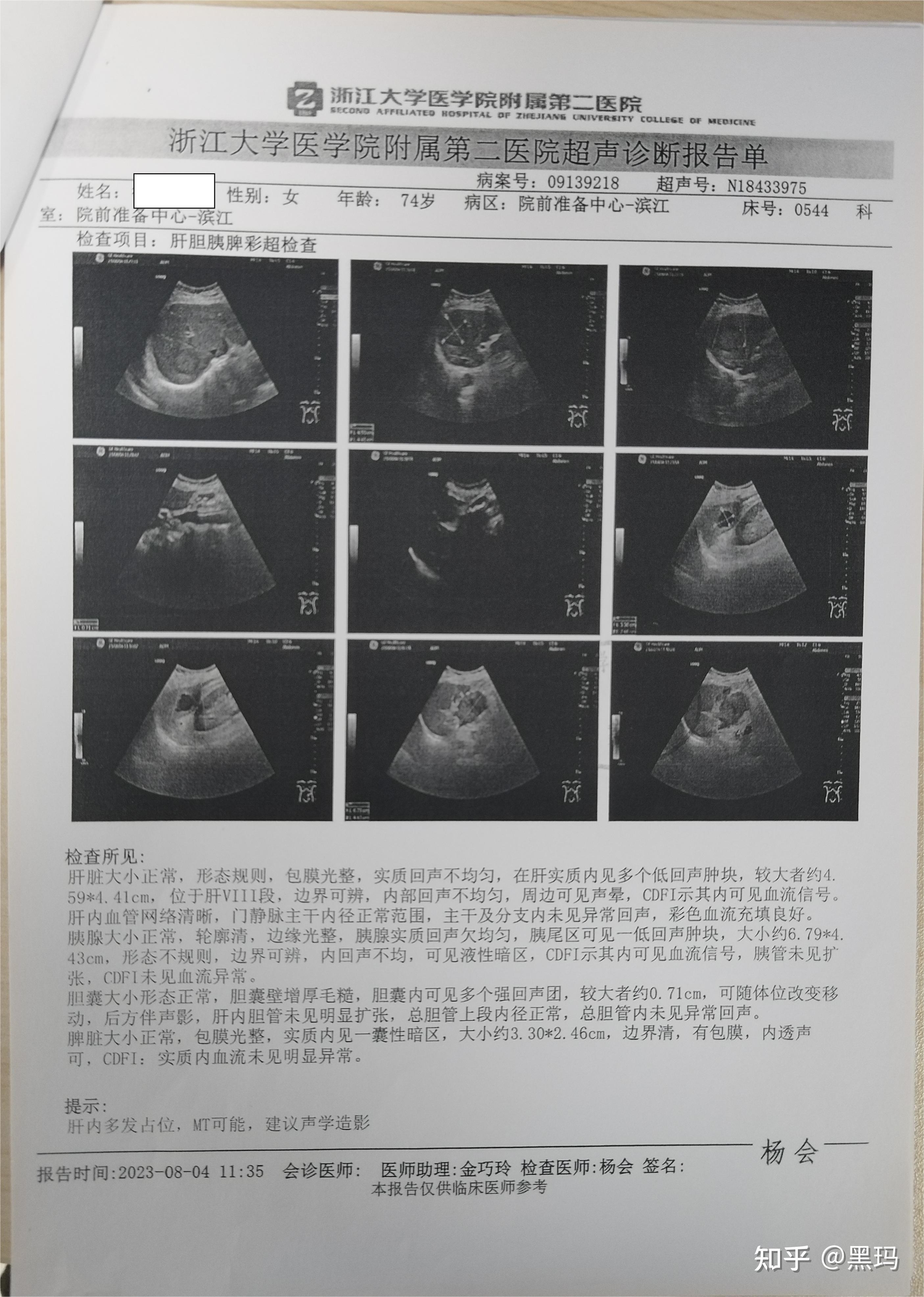 吉西他滨+顺铂图片