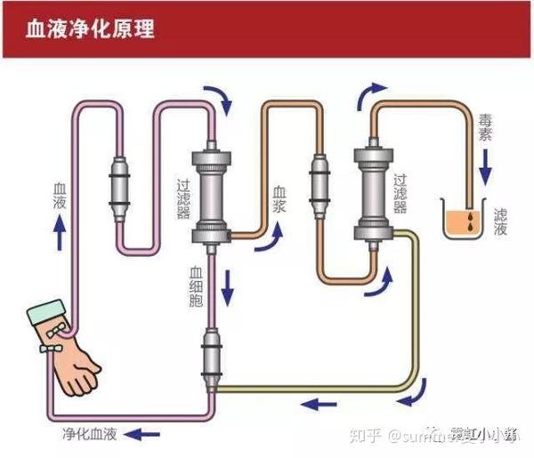 超人气的血液净化是什么 赴日治疗全过程 知乎