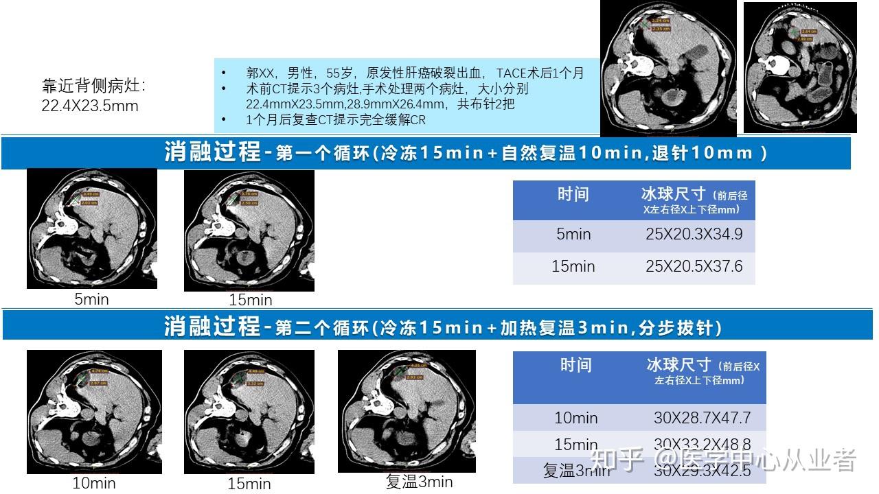康博刀医学中心手术案例5月22日更新