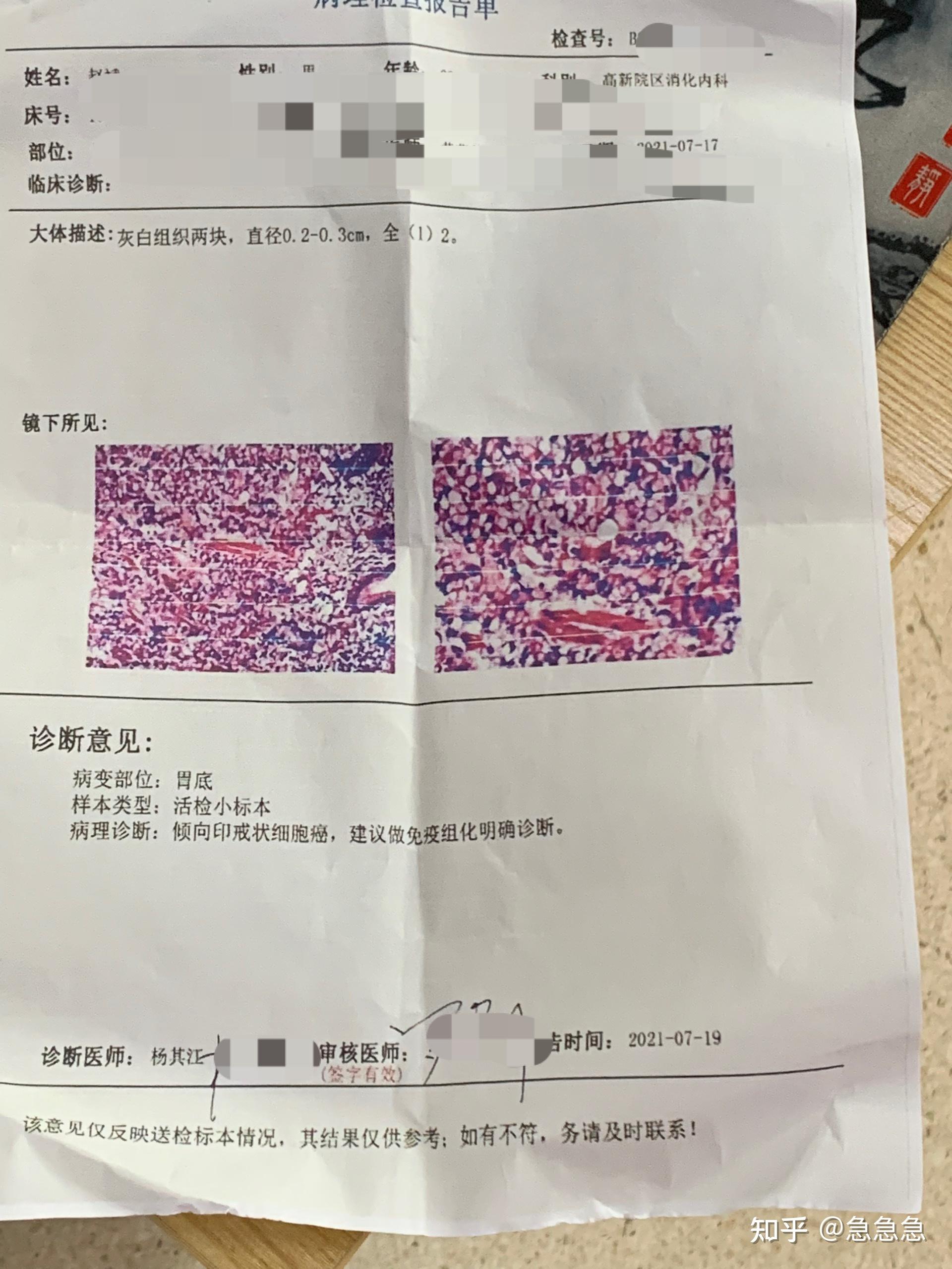 胃癌化验单 制作图片