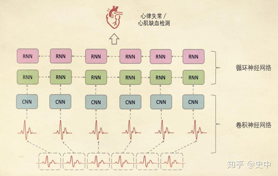 v2-fc52804c4b4aedf0958b1b83e05a3b81_b.jpg 互联网巨头如何用医疗AI回答尊严与生命之问?