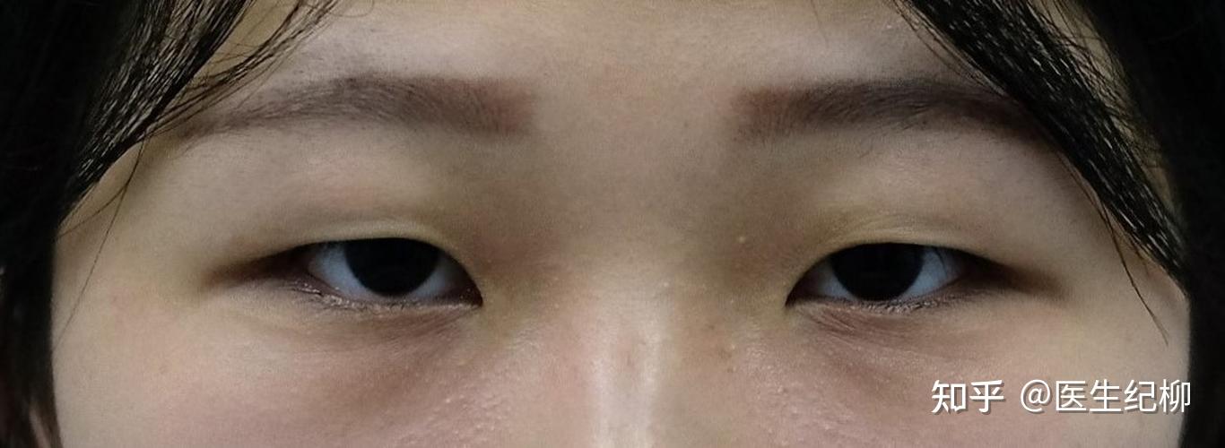 亲和力UP，笑眼的魅力 - 知乎