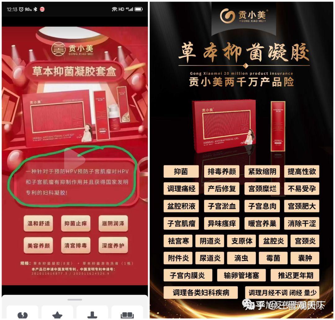 涉嫌传销虚假宣传?自称要做私护行业老大的"贡小美"遭网友质疑