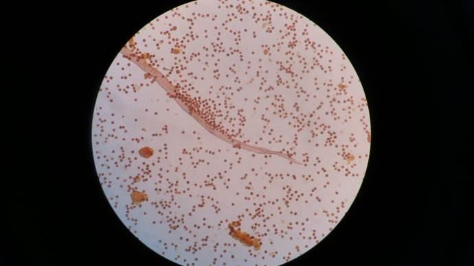 家里收留的三只小猫咪,养了一个多月了,居然在屁股上看见了白色的虫卵