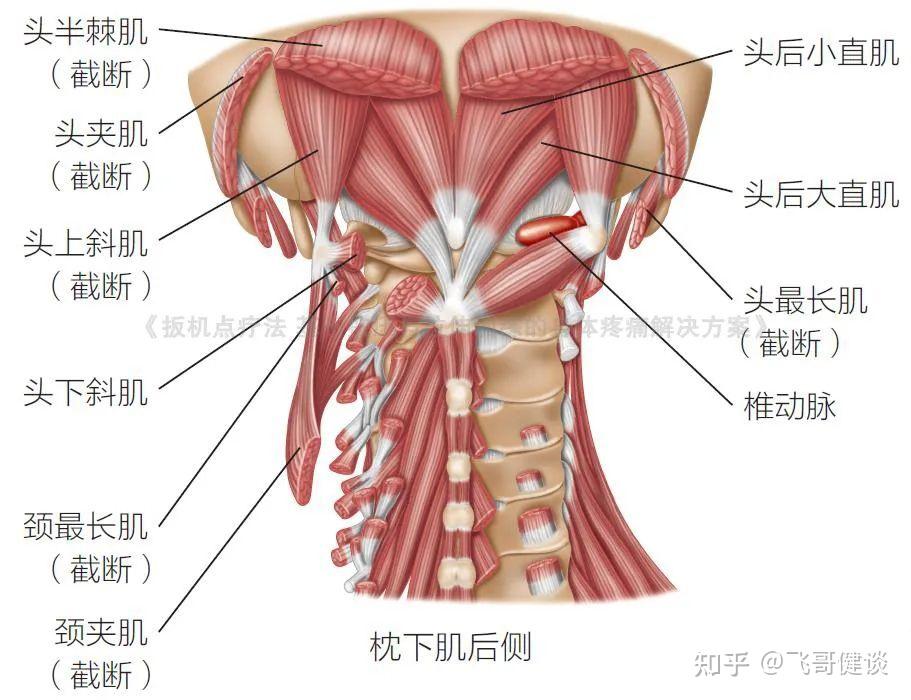 颈夹肌激痛点图片