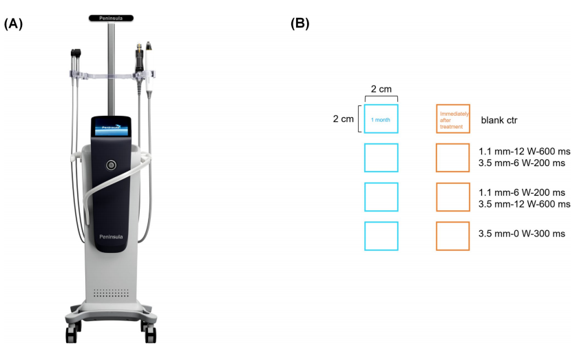 Matrix Pro Rfmn 中国医学科学院整形外科医院——闫言教授最新研究:半岛逆时针重塑肌肤的临床与组织学研究 - 知乎