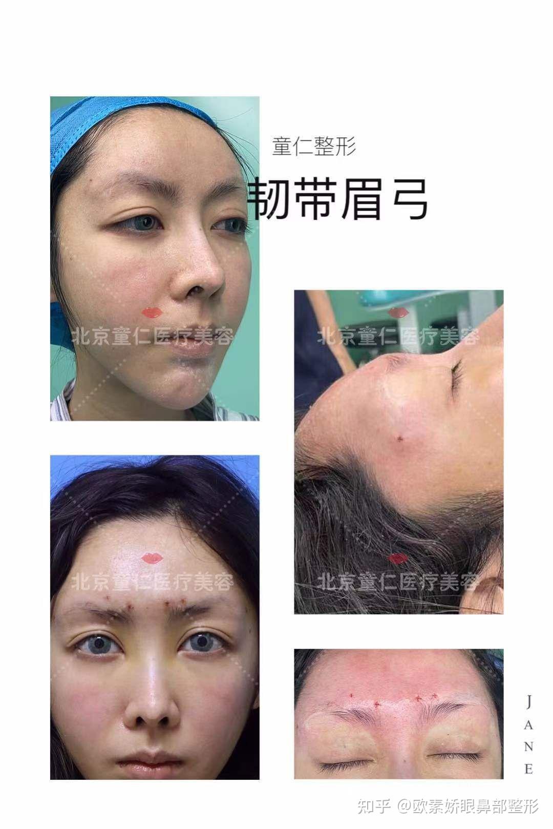 徐州市中心医院成功实施经眉弓入路微创手术 切除患者颅底肿瘤 - 全程导医网