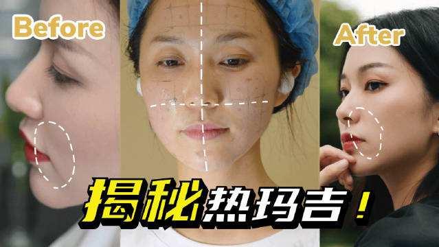 v2-fd8188b0128044c88e5bf767394b7a9e_1440w.jpg?source=172ae18b