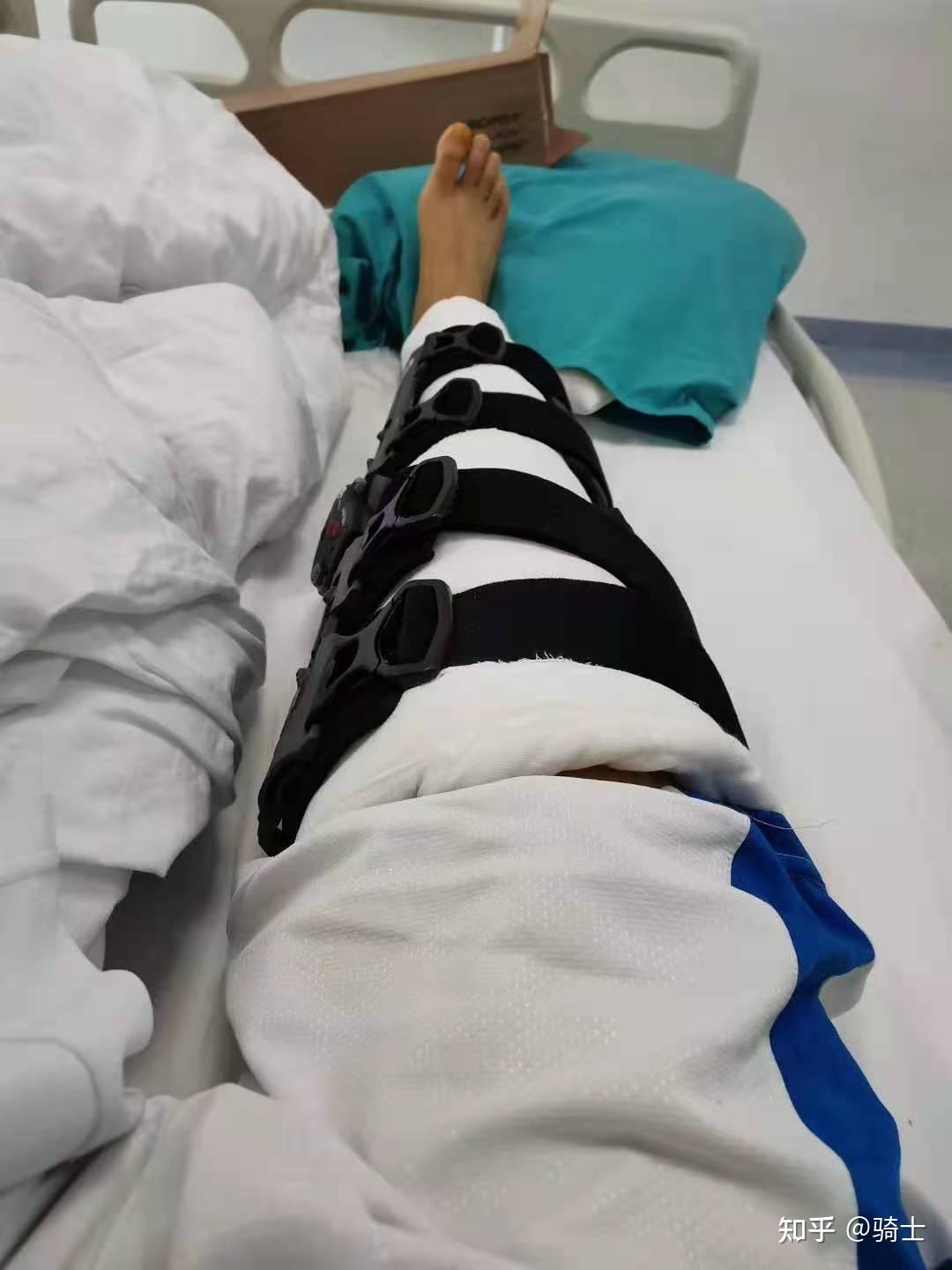 医院腿受伤的照片图片