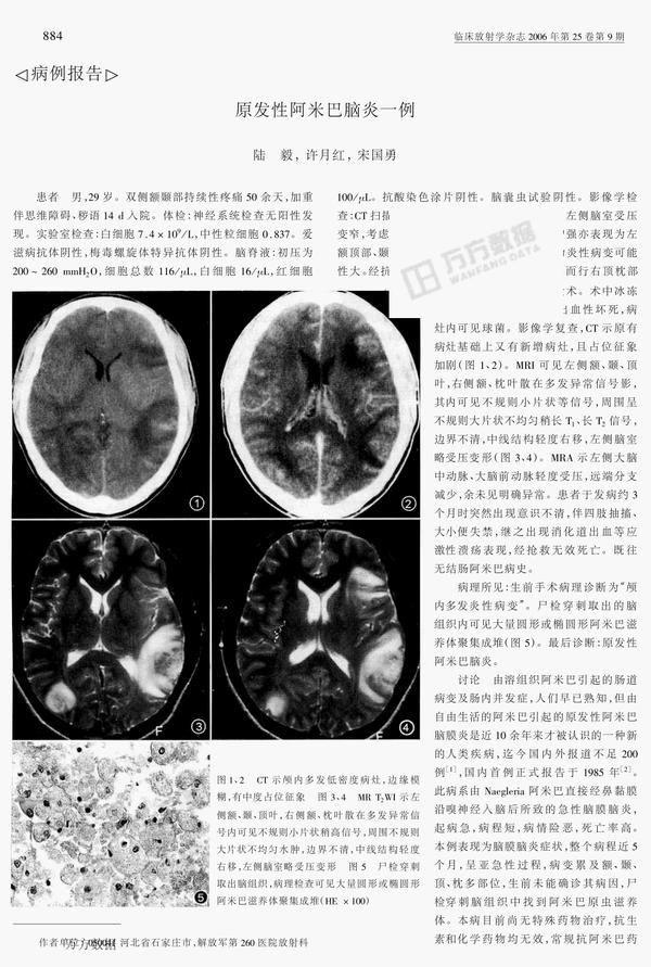 关于阿米巴脑膜炎治愈案例的治疗方法的备份