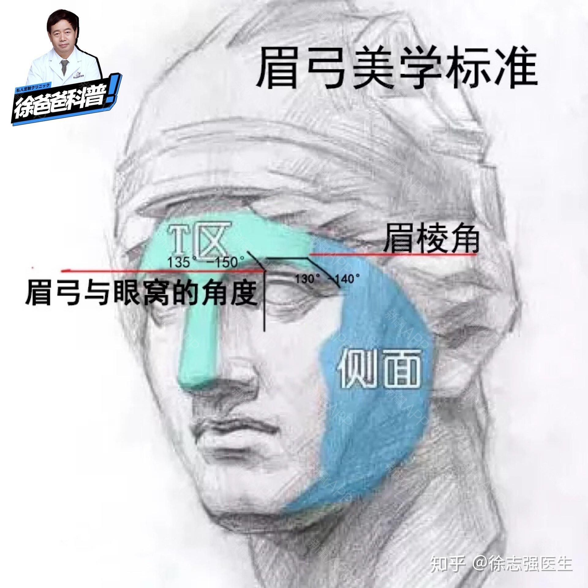 什么情况下需要做眉弓呢?如何选择眉弓的材料? - 知乎
