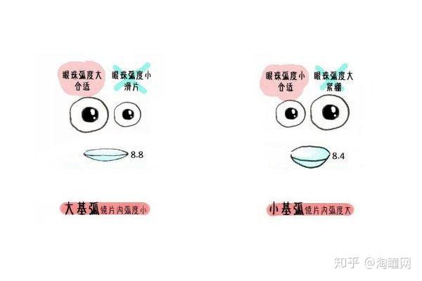 隐形眼镜基弧是什么?