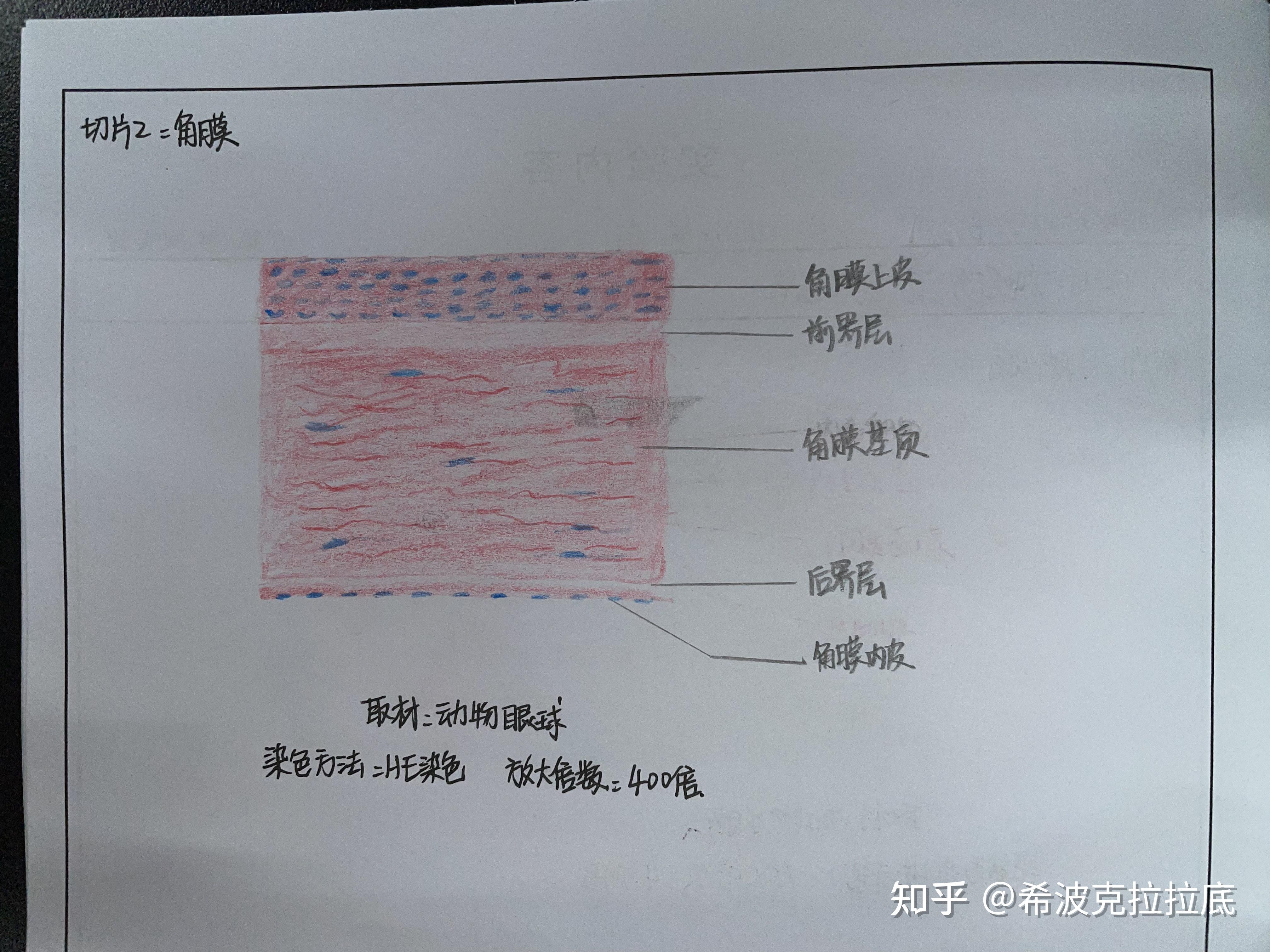 角膜视网膜内耳螺旋体