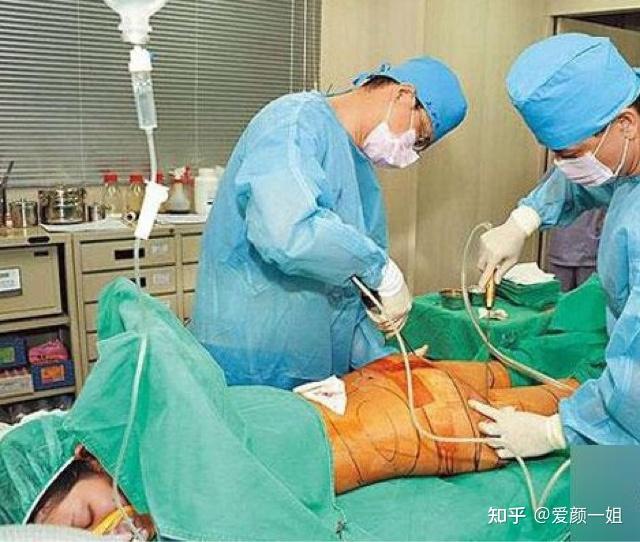对网红小冉抽脂感染死亡事件,从医美角度剖析大腿腰腹抽脂有什么风险