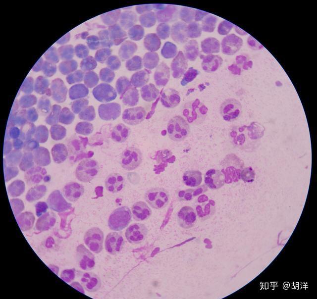 v2-fe1eca25614c6d9586ddaba7589b7afd_r.jpg