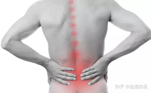 急性腰痛 怎么办 知乎