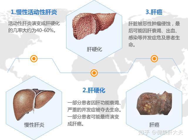 自身免疫力是如何形成肝炎的