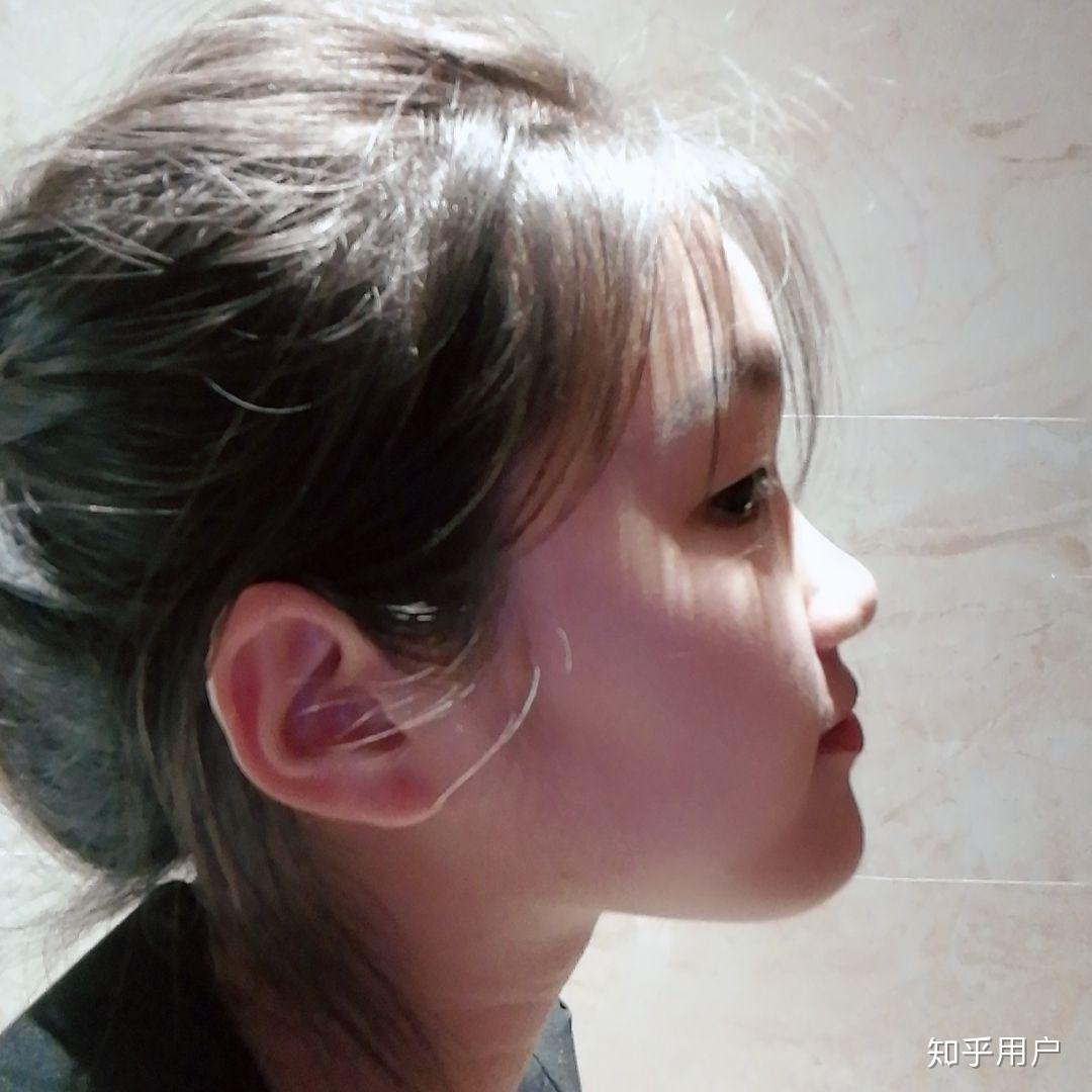 女孩子塌鼻梁(山根低)是怎样的体验?