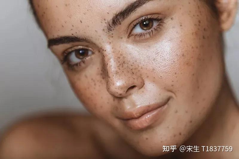 二,外部因素4,错误使用化妆品:使用了不适合自己皮肤的化妆品,导致