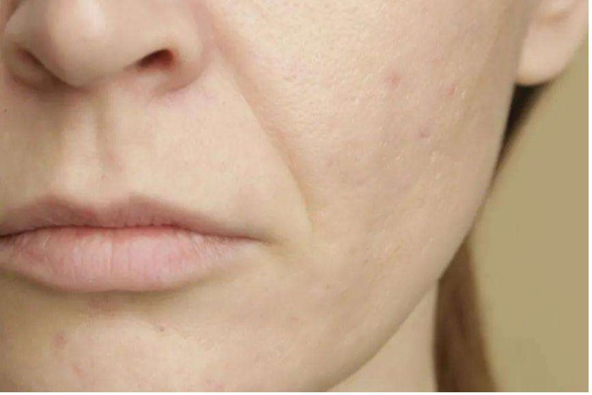 念自然科普皮肤暗沉发黄几招教您改善