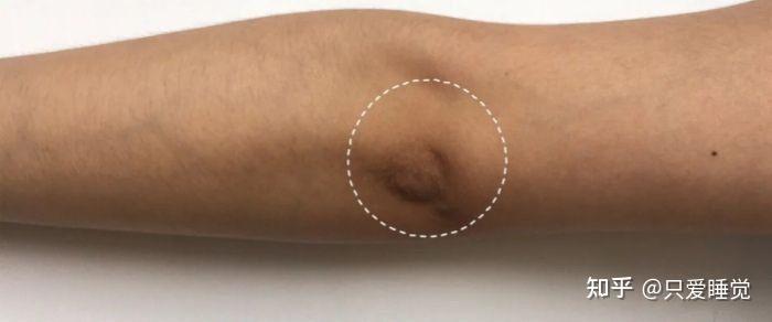 关节黑怎么美白呢